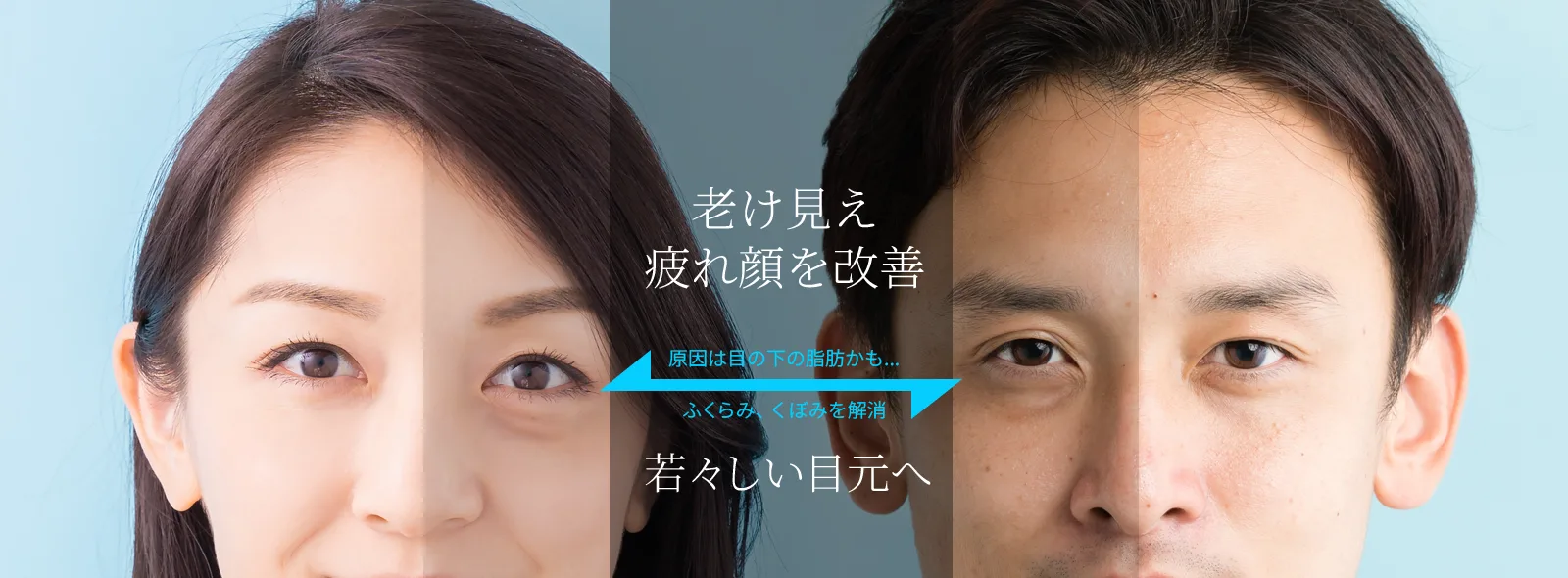 注入治療(ヒアルロン酸・アルジェネス)