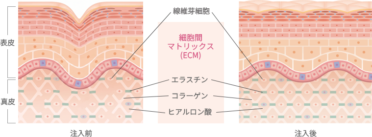 スネコス&reg;パフォルマとは