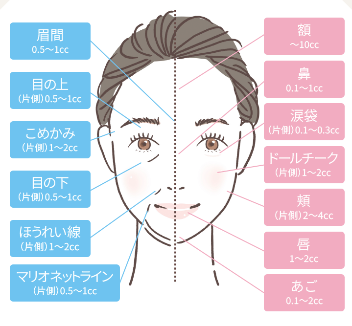 フィラー注入目安量