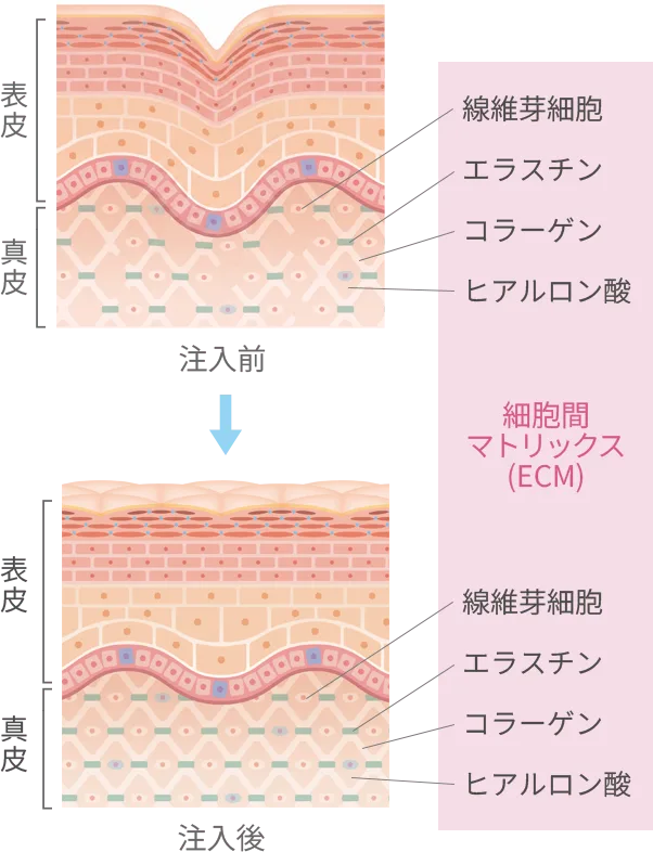 肌育注射とは
