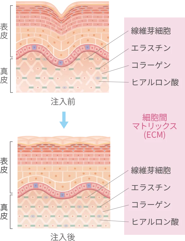 スネコス&reg;パフォルマとは
