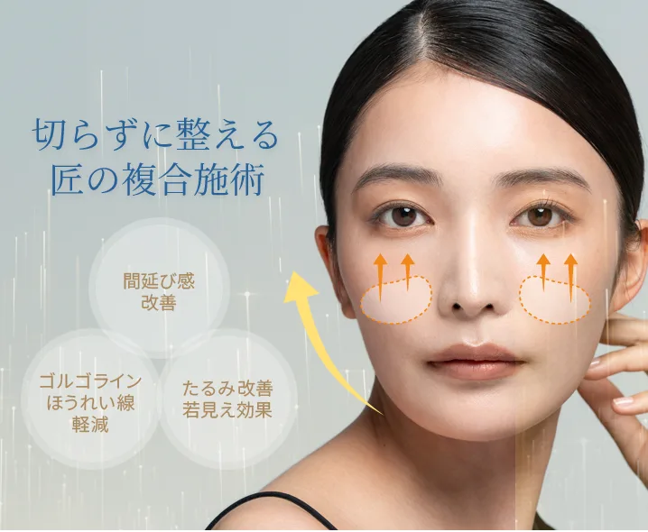 TAKUMI式中顔面短縮術
